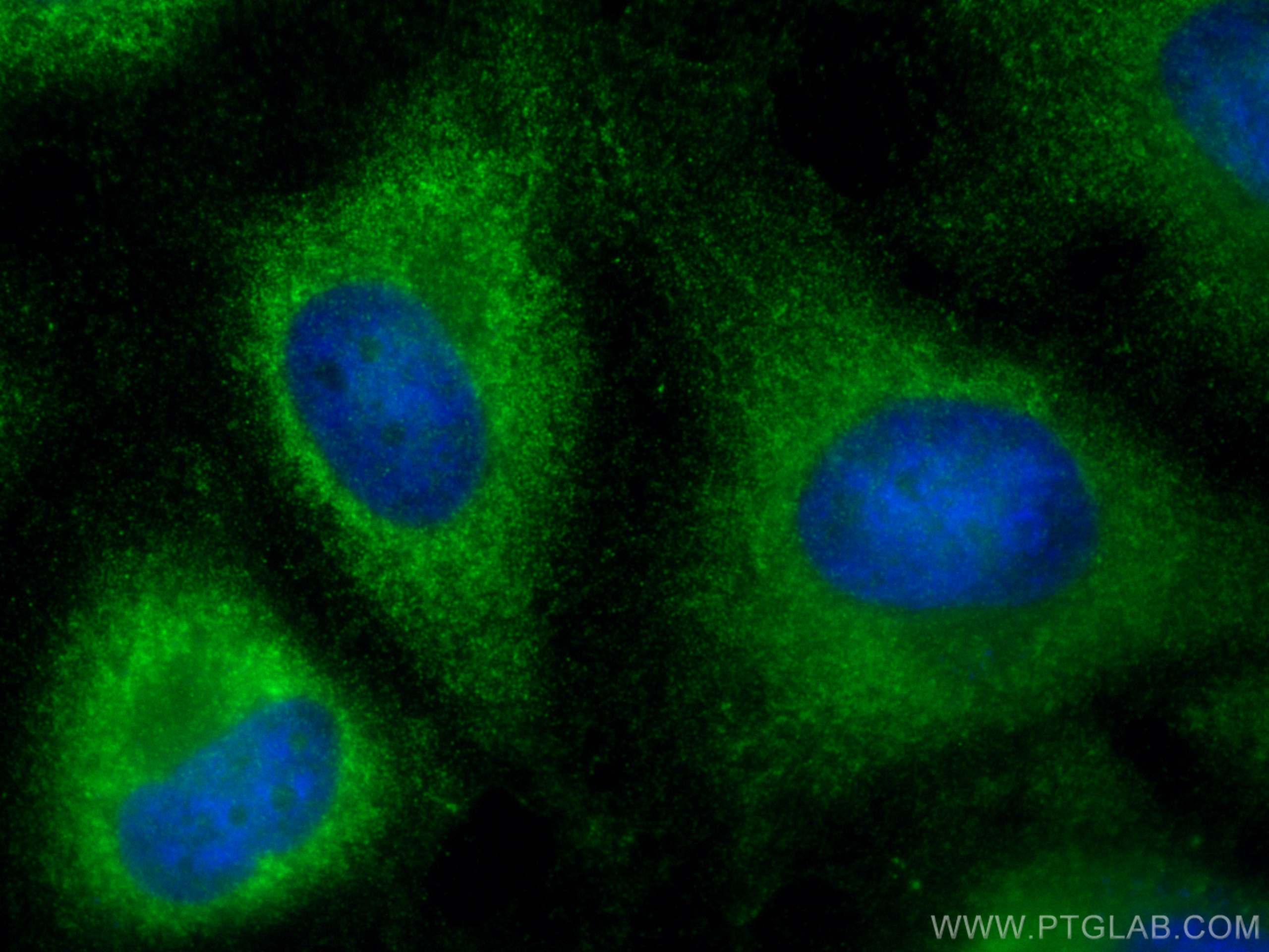 IF Staining of HeLa using 19493-1-AP