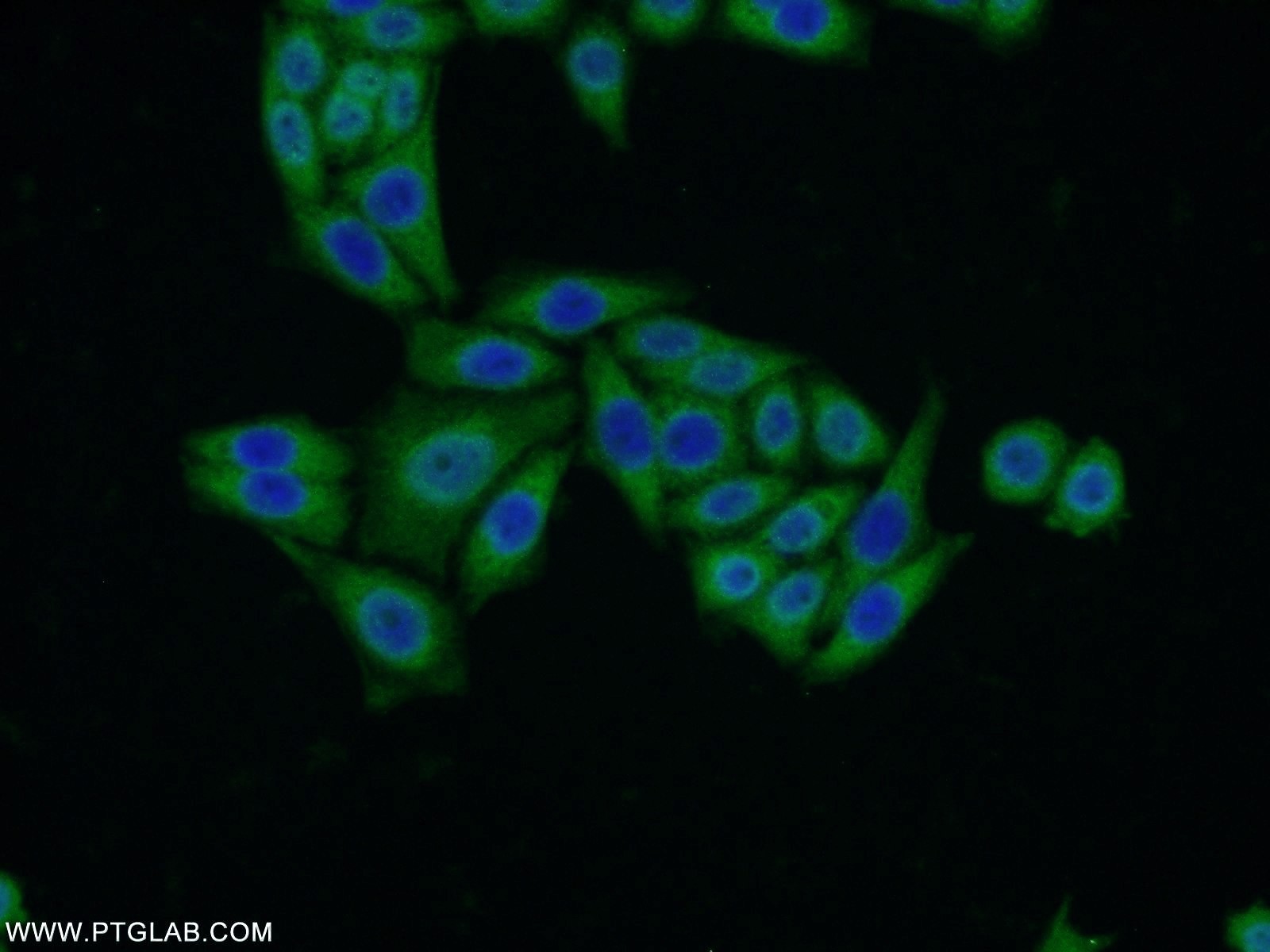 IF Staining of HeLa using 21577-1-AP