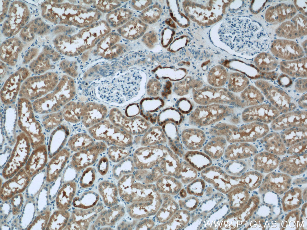 IHC staining of human kidney using 21577-1-AP