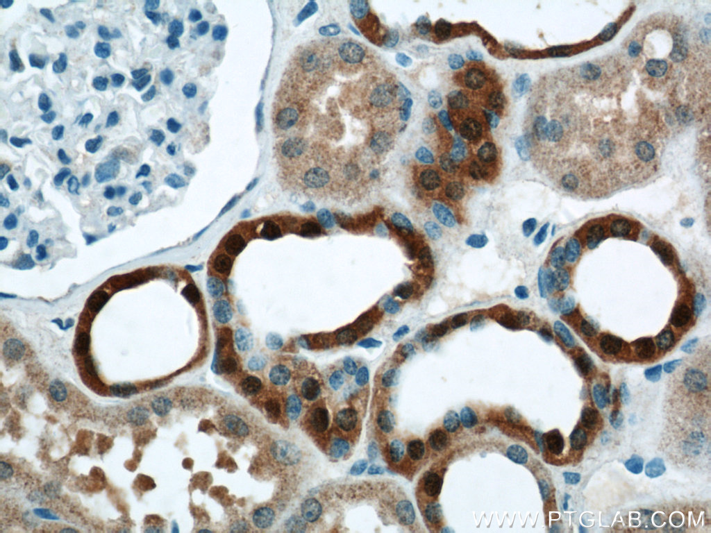 IHC staining of human kidney using 21577-1-AP