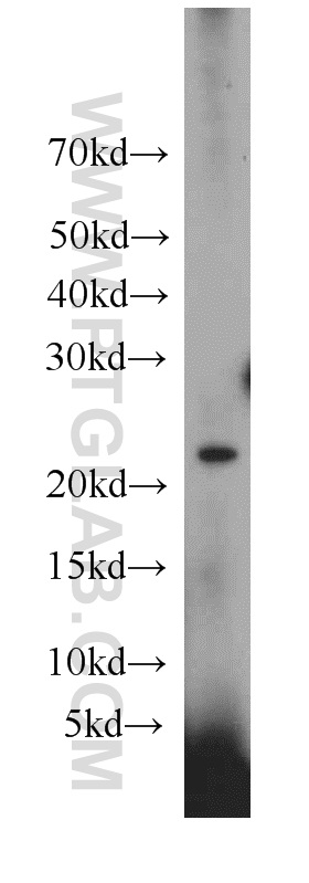 WB analysis of HeLa using 21577-1-AP (same clone as 21577-1-PBS)