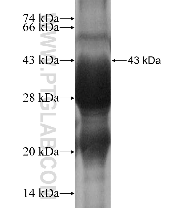 VMO1 fusion protein Ag16120 SDS-PAGE