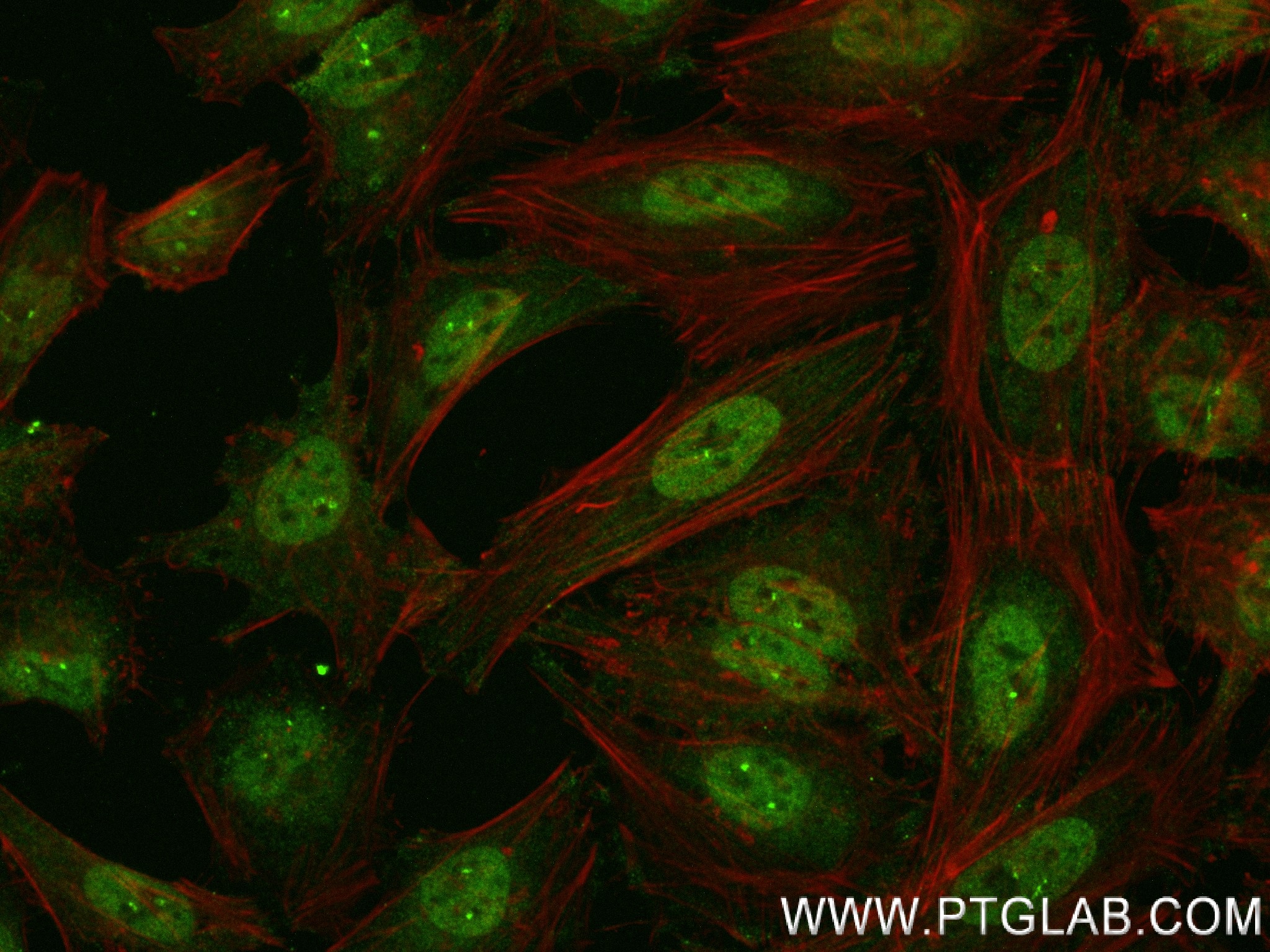 IF Staining of HeLa using 83901-3-RR