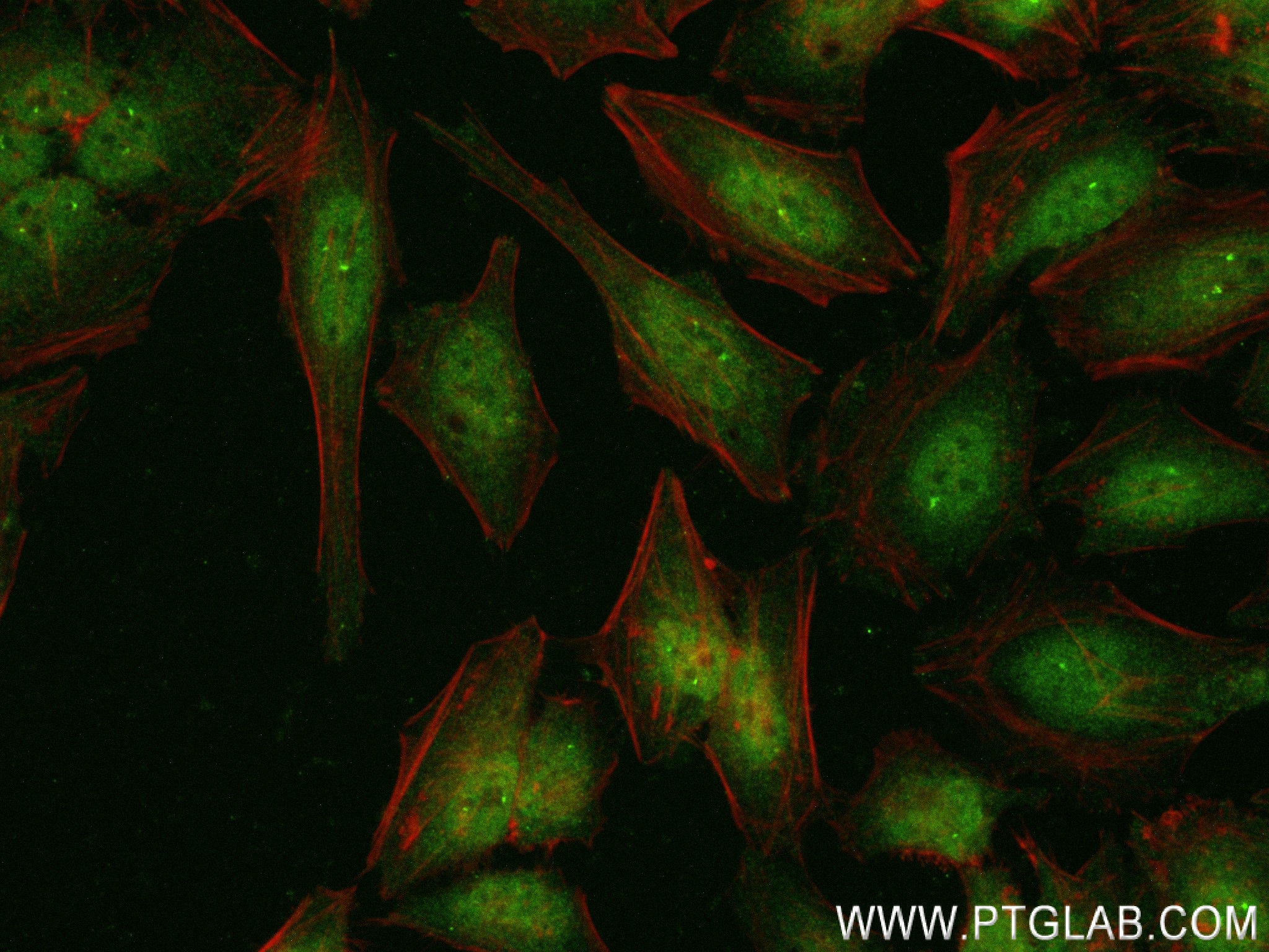 IF Staining of HeLa using 83901-5-RR (same clone as 83901-5-PBS)