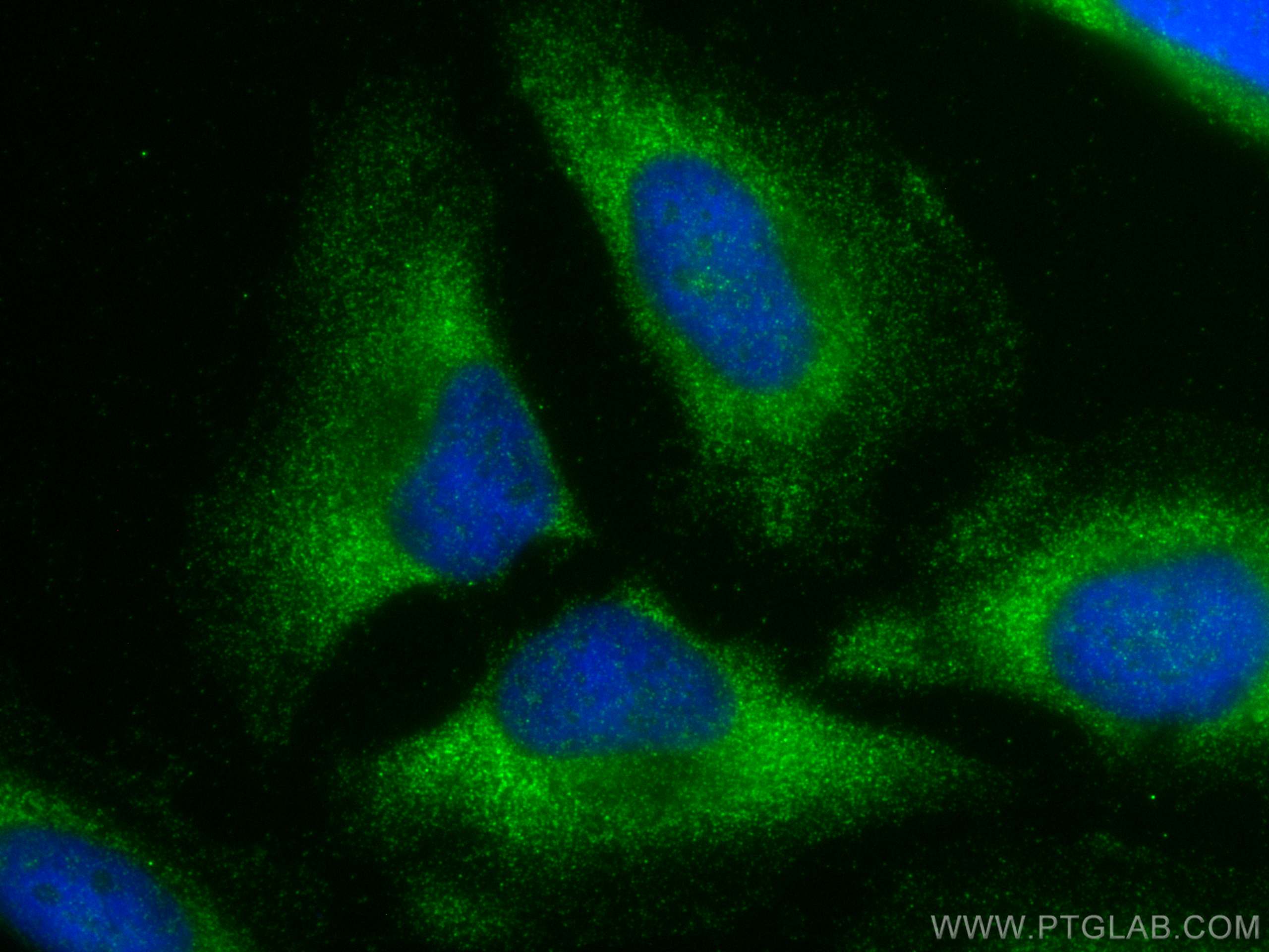 IF Staining of HeLa using 24505-1-AP