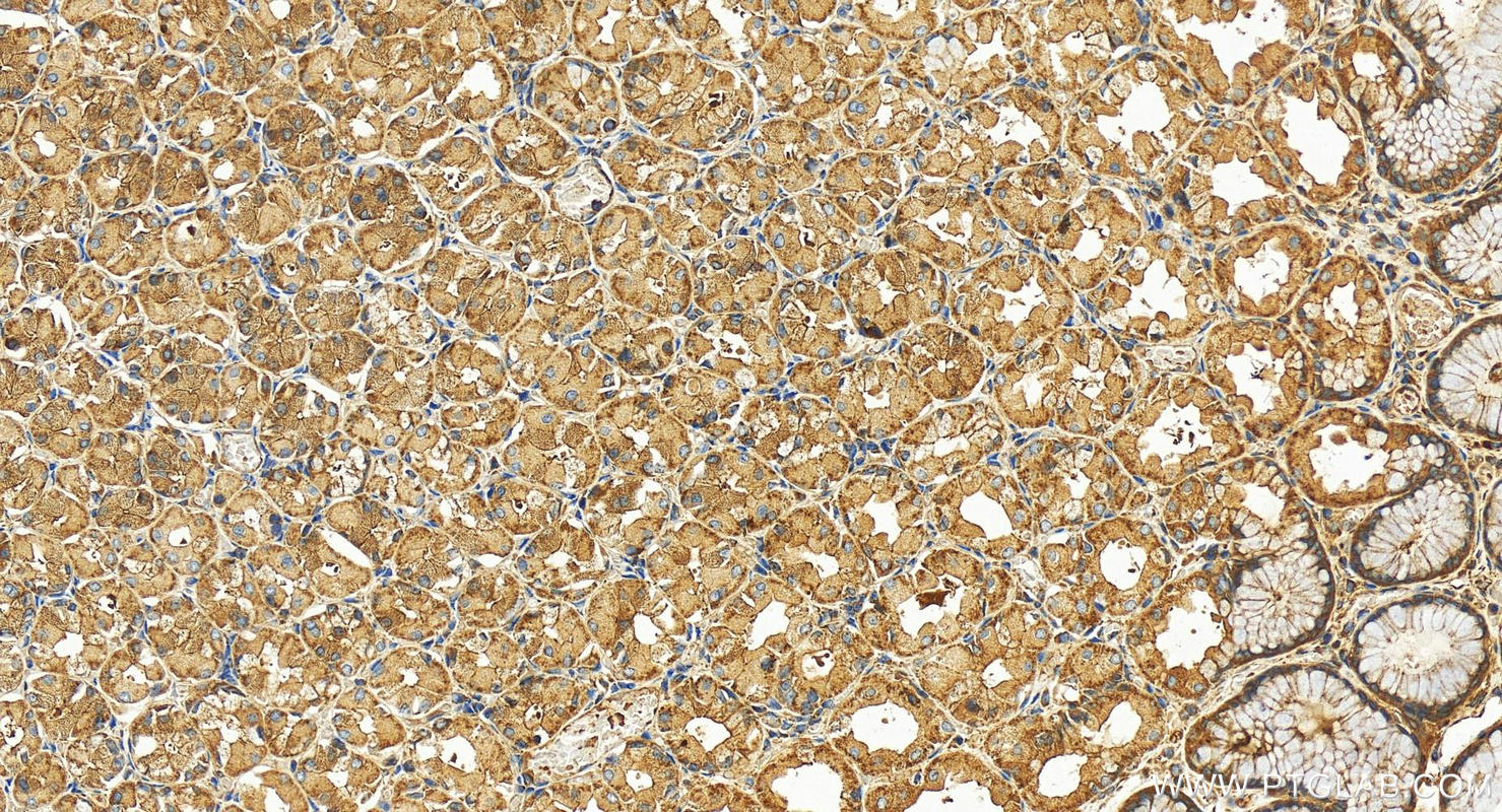 IHC staining of human stomach using 28676-1-AP