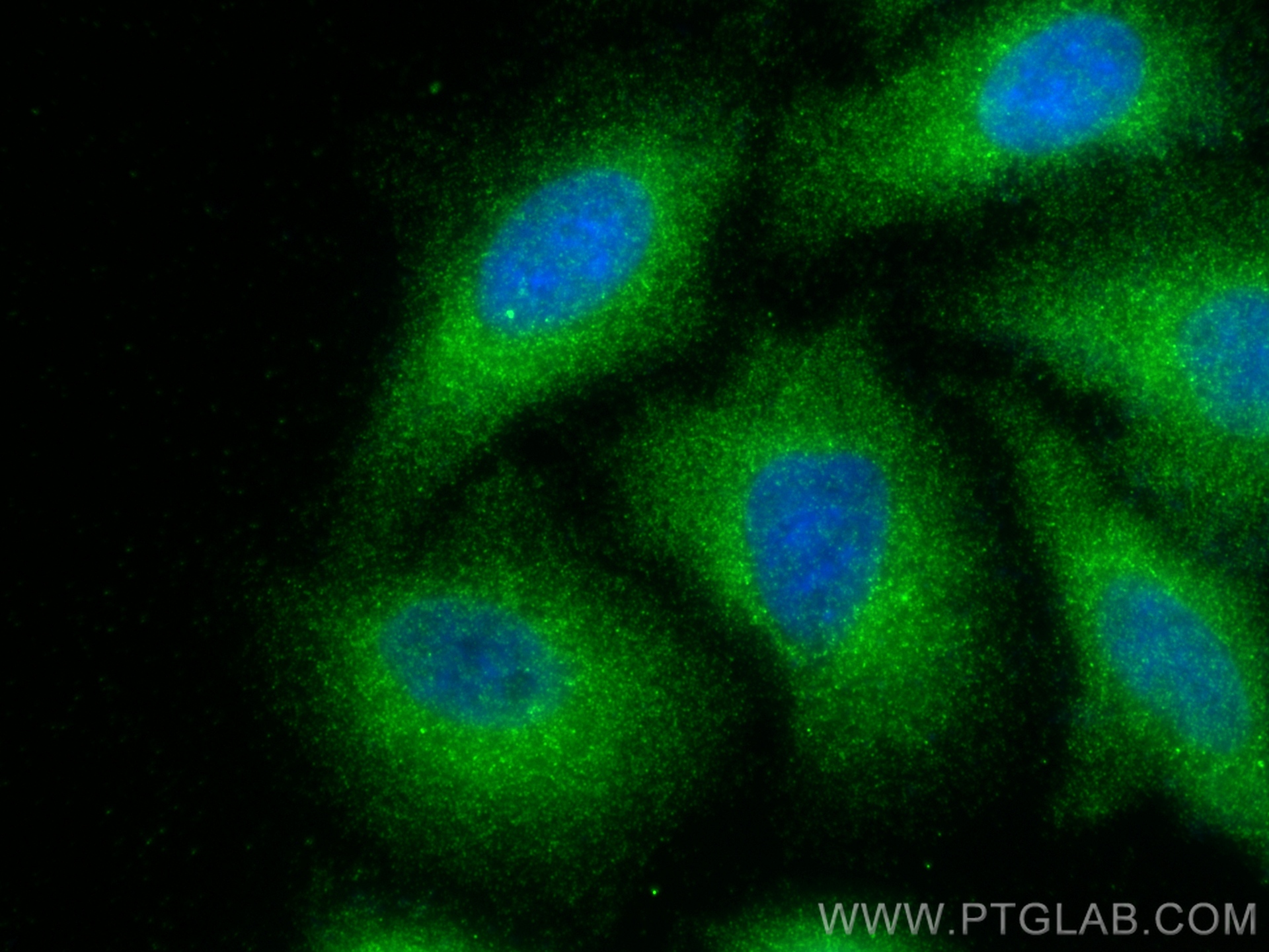 IF Staining of A549 using 10901-1-AP