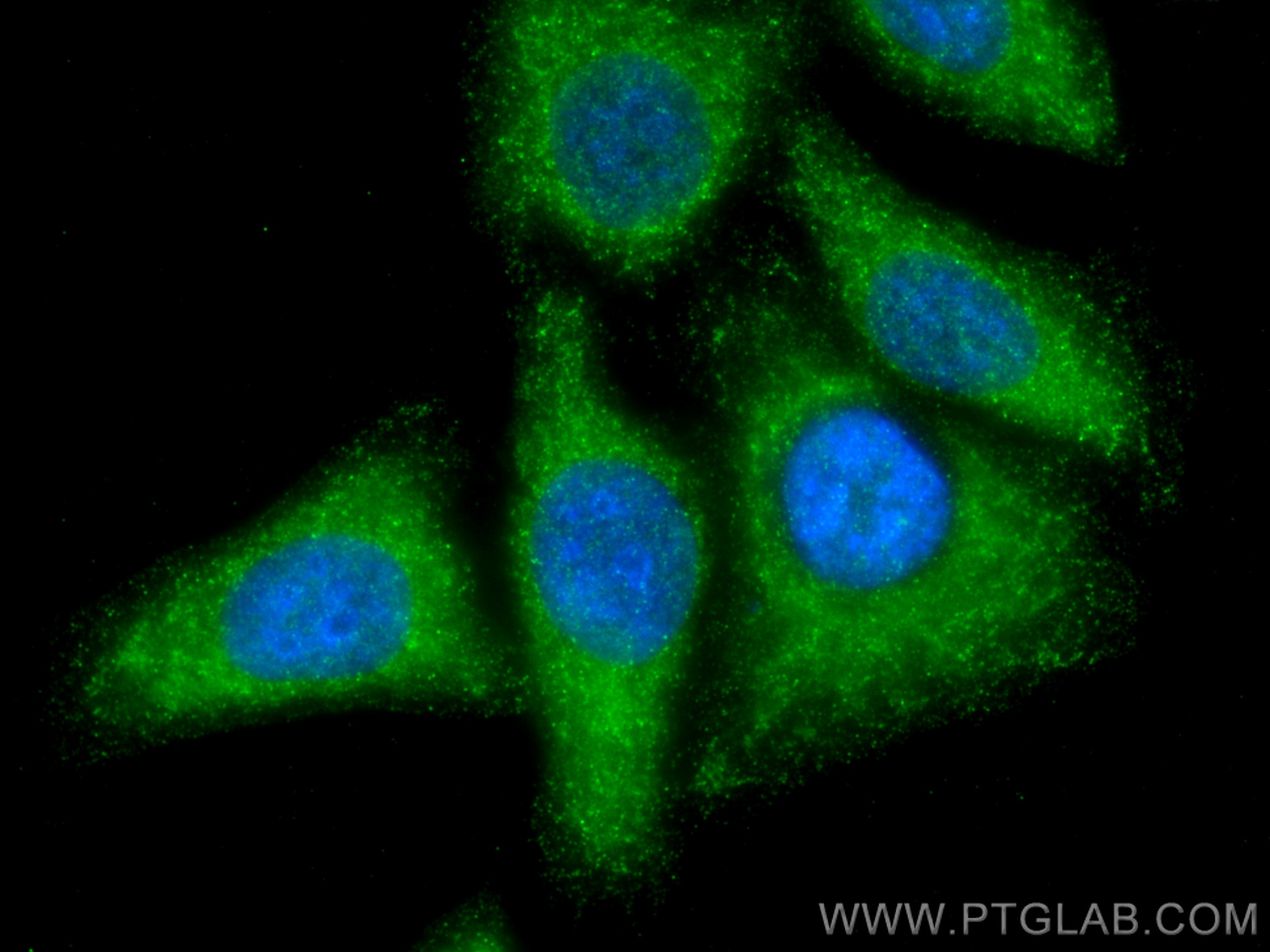 IF Staining of HepG2 using 15669-1-AP