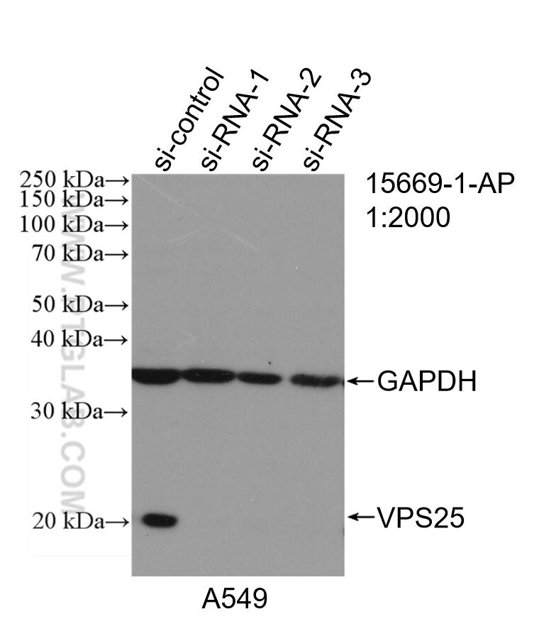 WB analysis of A549 using 15669-1-AP