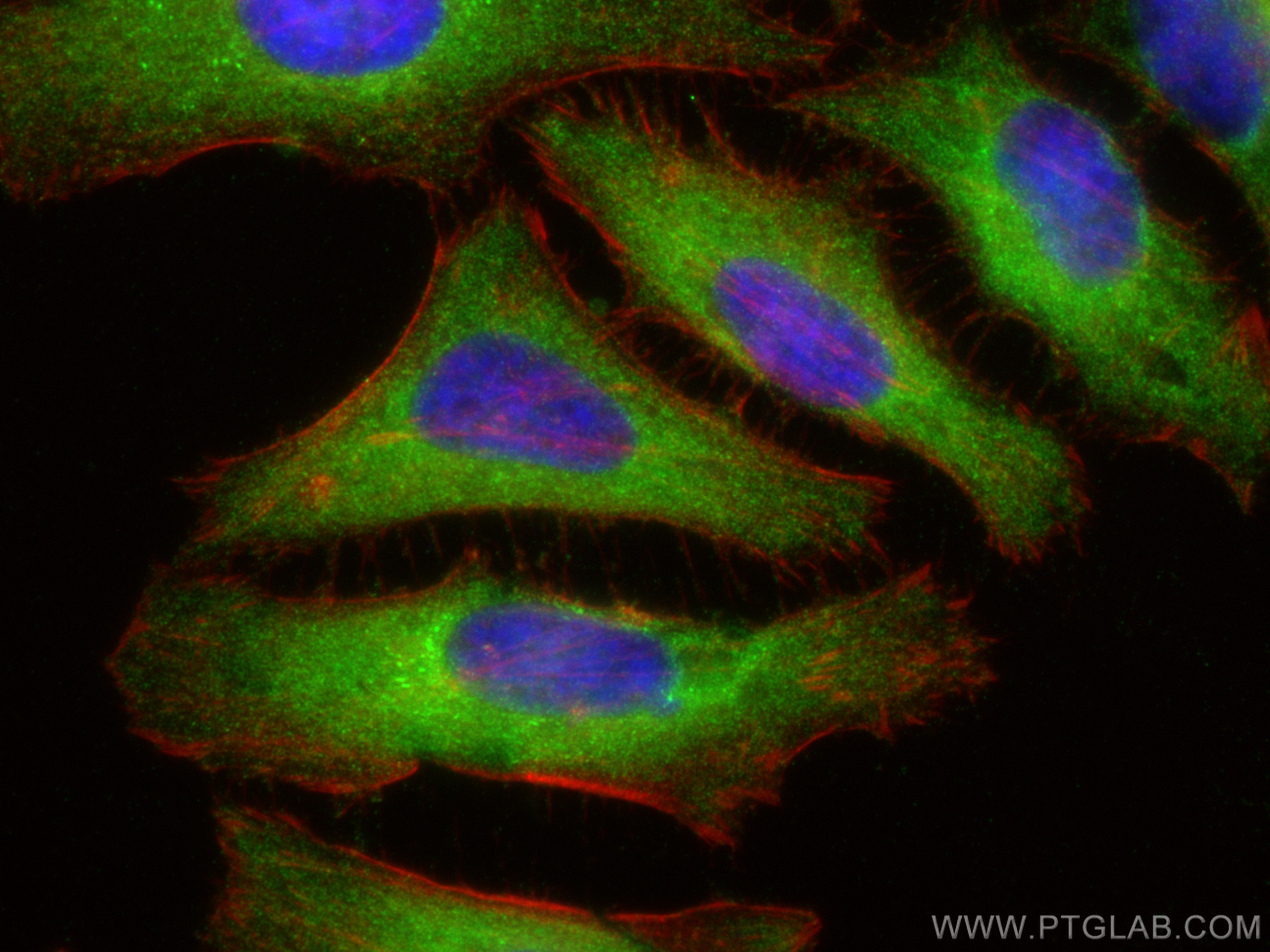 IF Staining of HeLa using 15915-1-AP