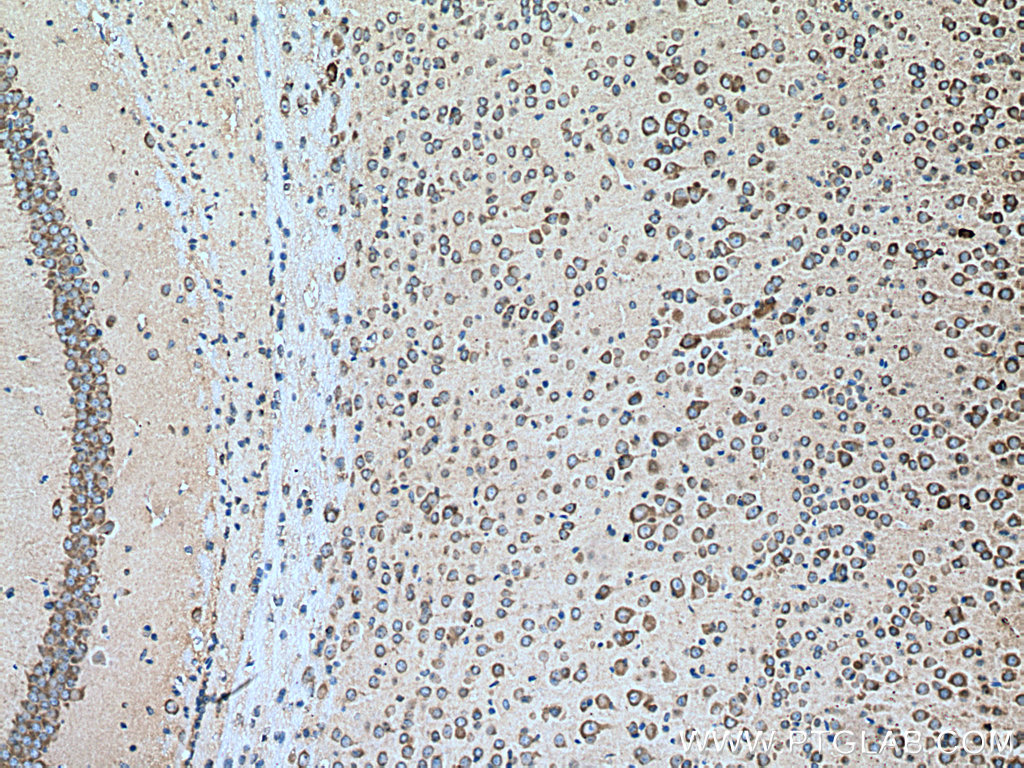 IHC staining of mouse brain using 15915-1-AP