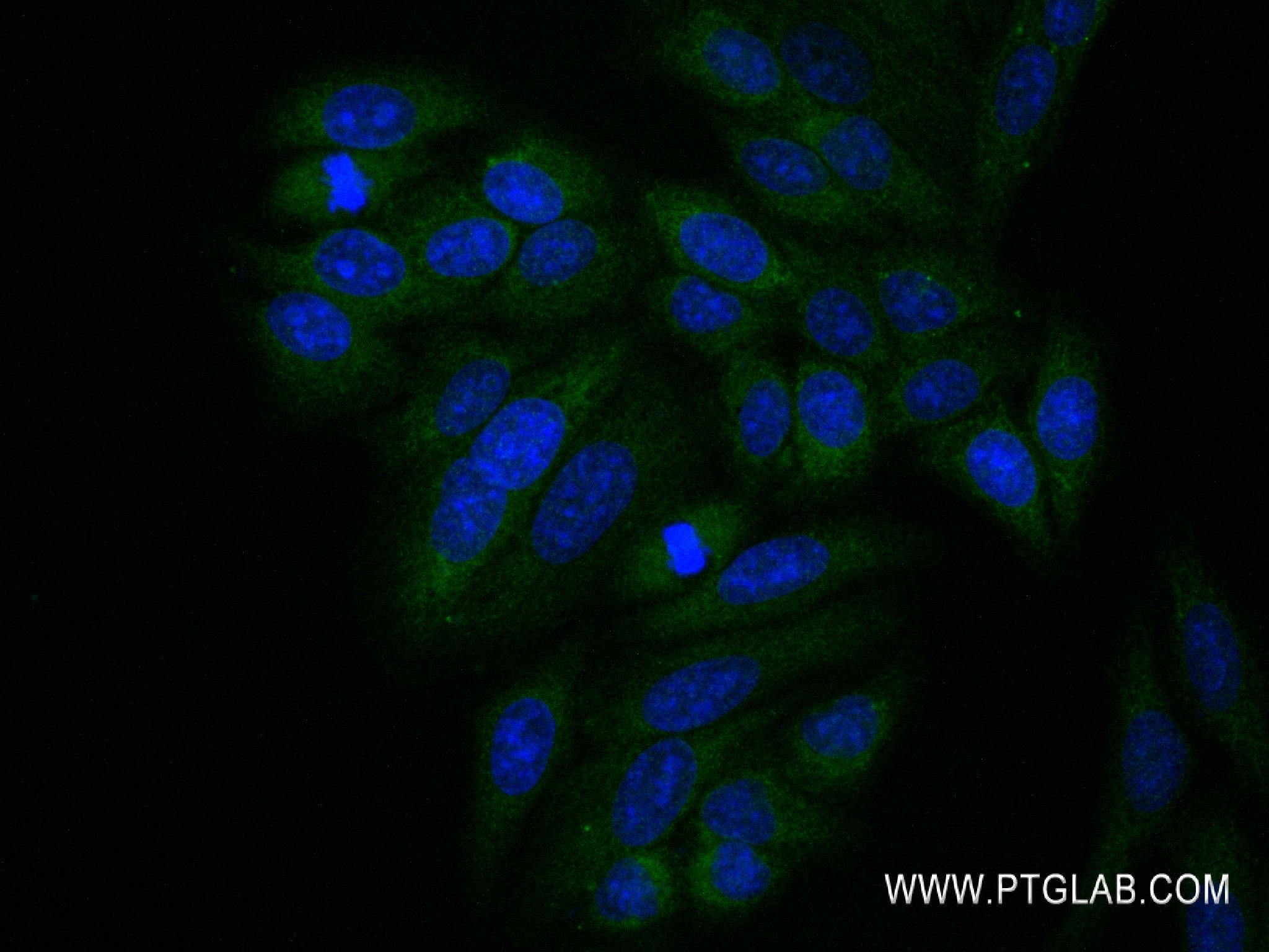 IF Staining of HepG2 using 84472-4-RR (same clone as 84472-4-PBS)