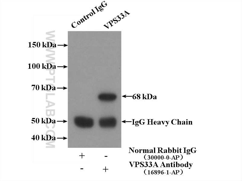 IP experiment of HepG2 using 16896-1-AP