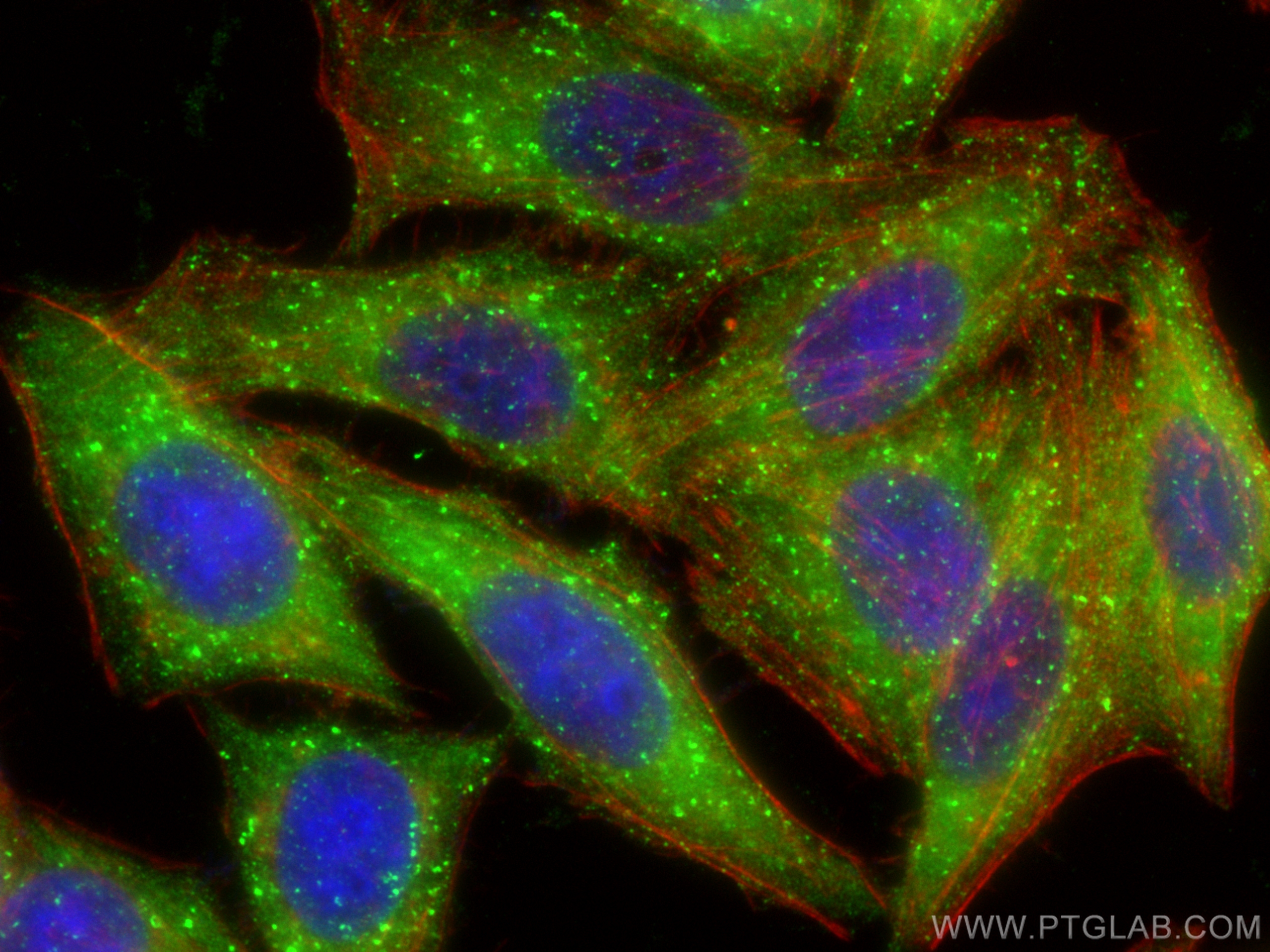 IF Staining of HepG2 using 10236-1-AP