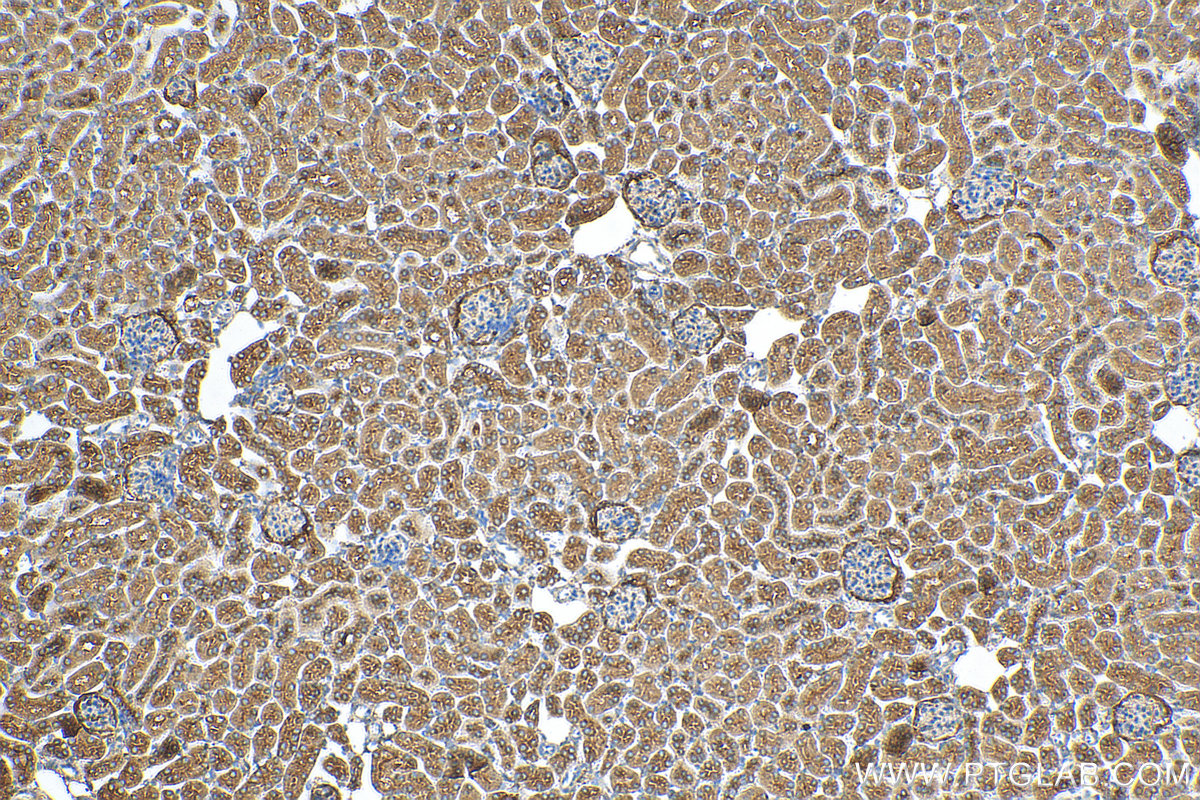 IHC staining of mouse kidney using 10236-1-AP