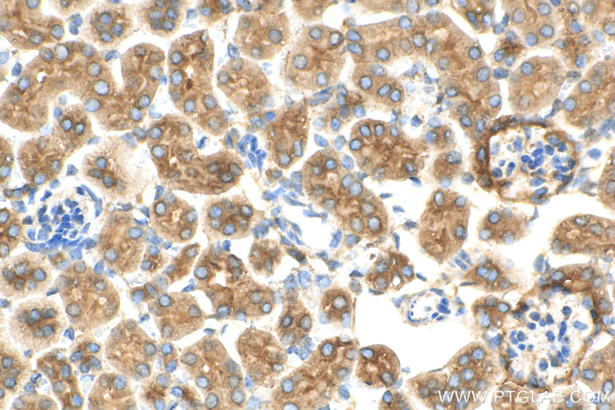 IHC staining of mouse kidney using 10236-1-AP