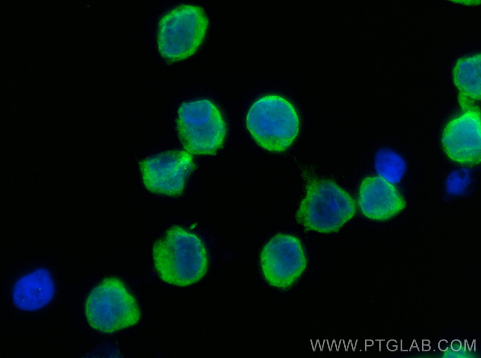 IF Staining of Raji using 27128-1-AP