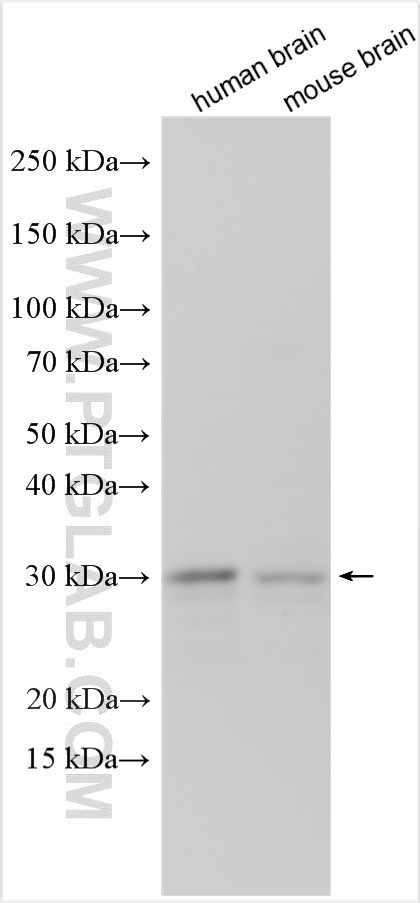 VPS37D