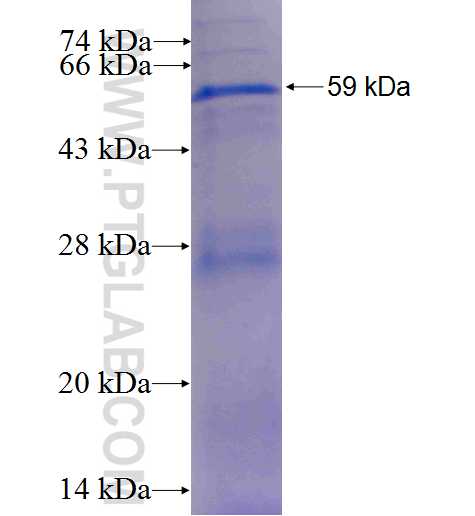 VPS45 fusion protein Ag3289 SDS-PAGE