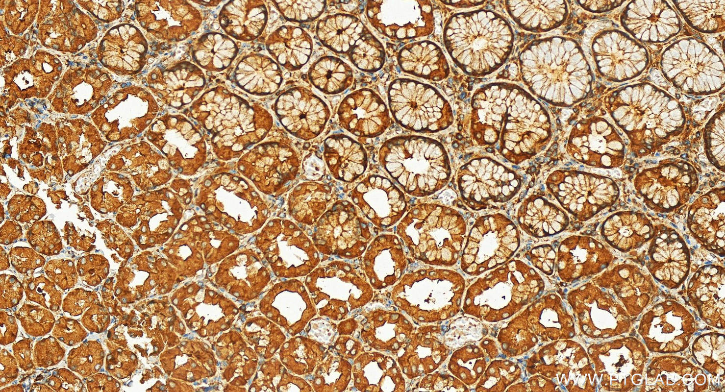 IHC staining of human stomach using 12824-1-AP