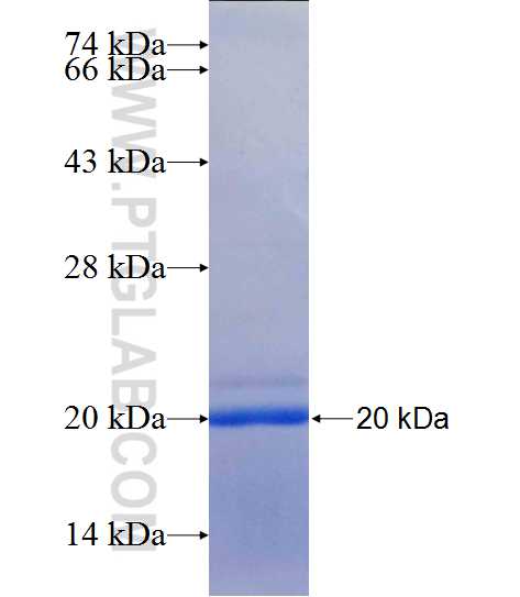 VPS53 fusion protein Ag25142 SDS-PAGE