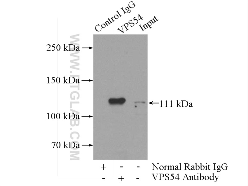 IP experiment of mouse brain using 13327-1-AP