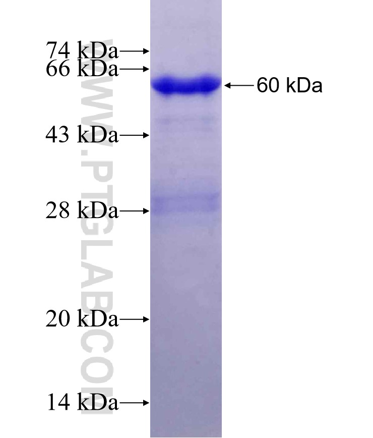 VPS54 fusion protein Ag29671 SDS-PAGE