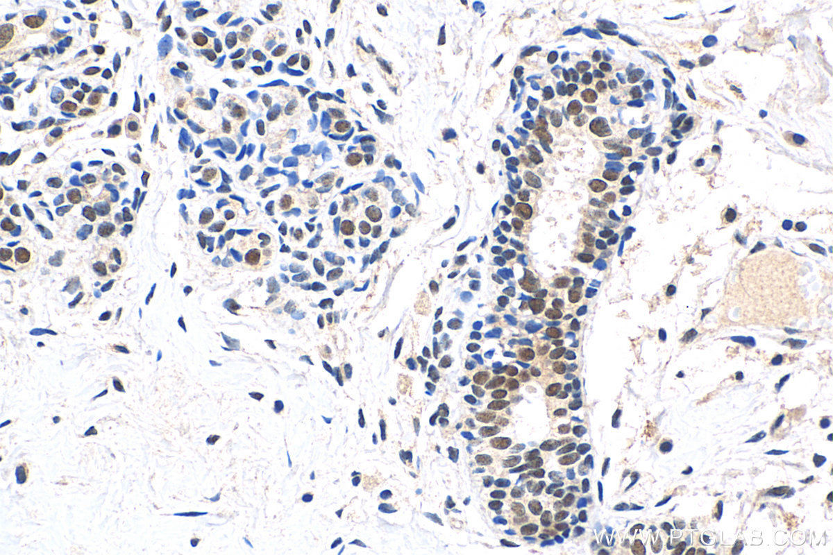 IHC staining of human breast hyperplasia using 15143-1-AP