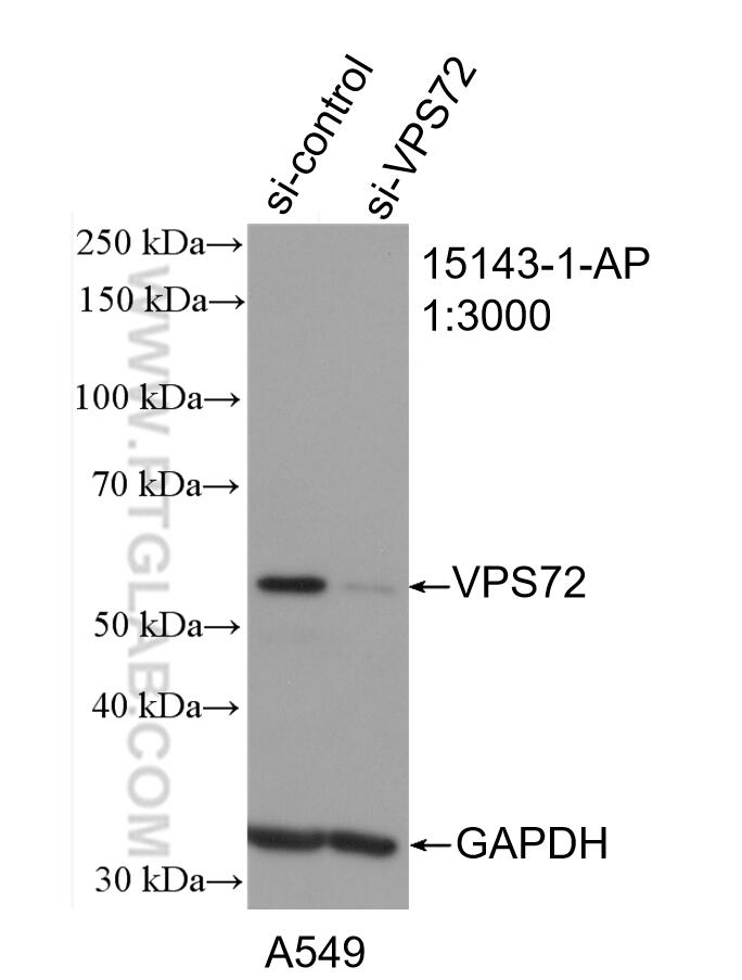 WB analysis of A549 using 15143-1-AP