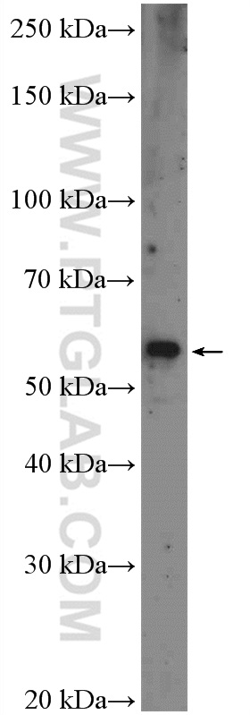 WB analysis of HeLa using 15143-1-AP