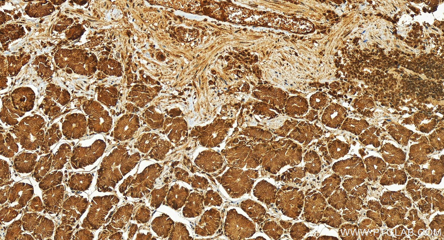 IHC staining of human stomach using 28018-1-AP