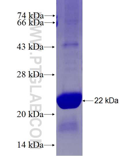 VRK1 fusion protein Ag27766 SDS-PAGE