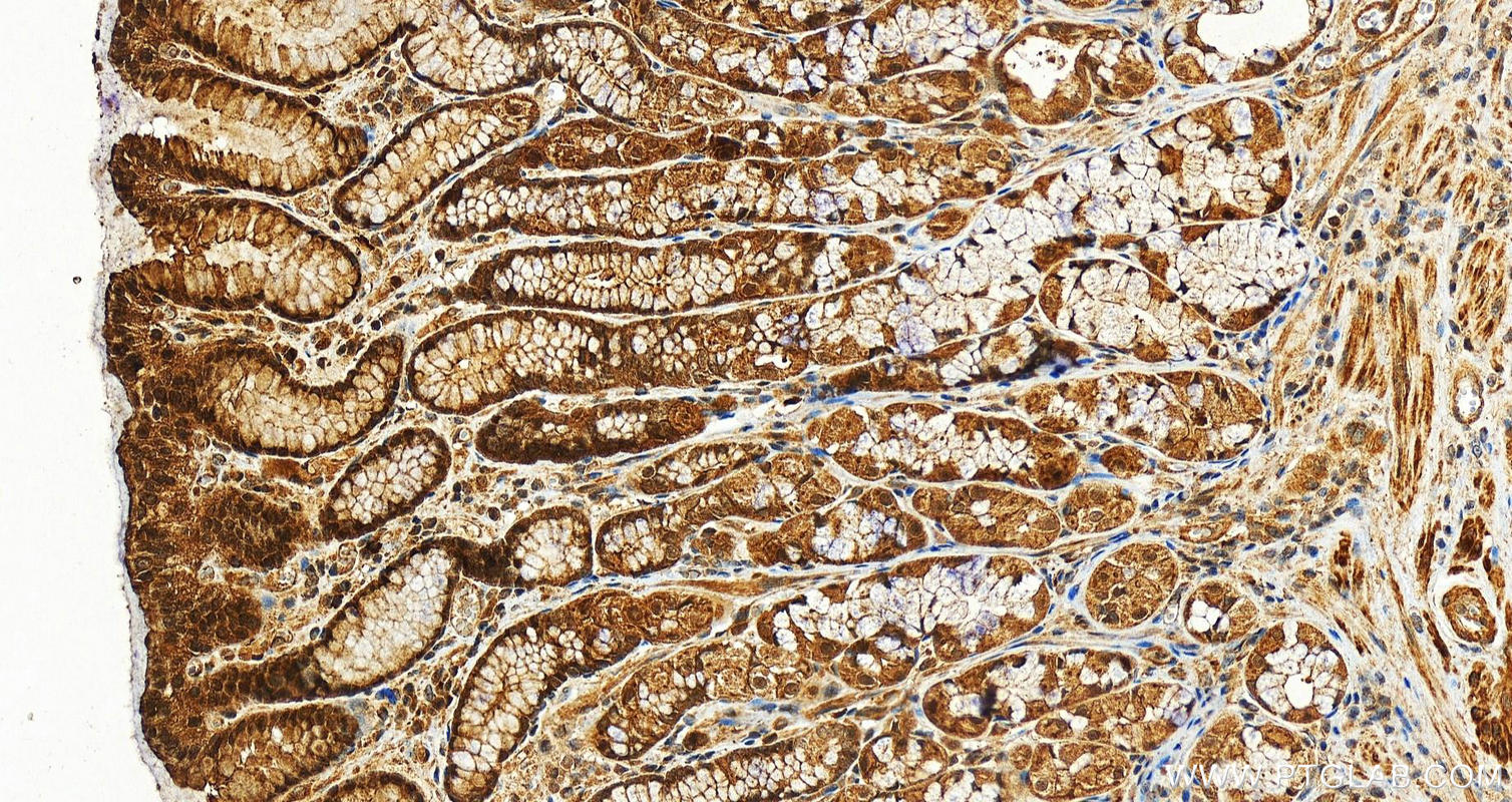 IHC staining of human stomach using 12946-1-AP (same clone as 12946-1-PBS)