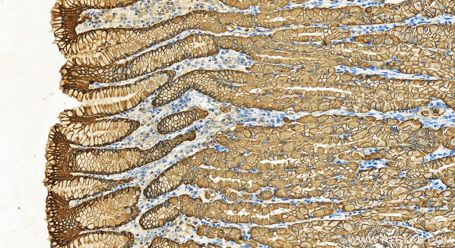 IHC staining of human stomach using 14145-1-AP