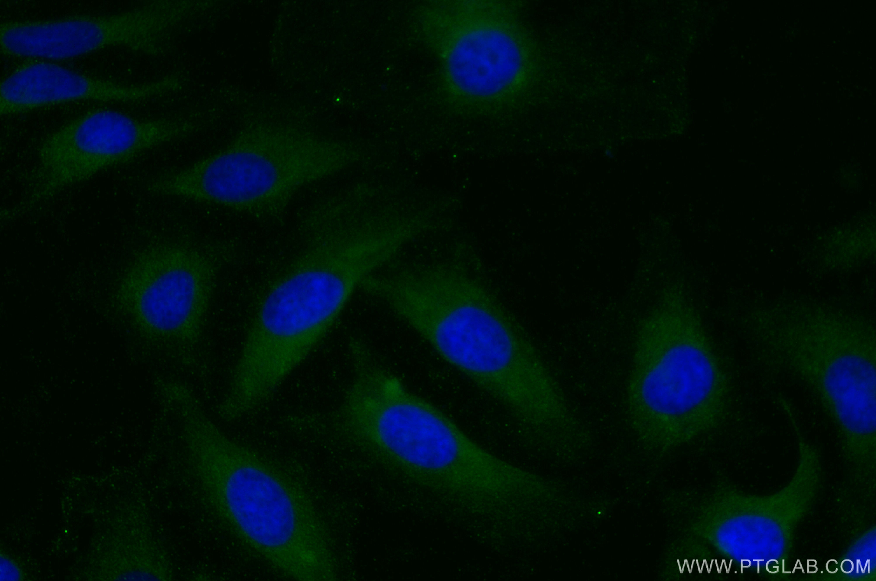 IF Staining of HeLa using 13919-1-AP