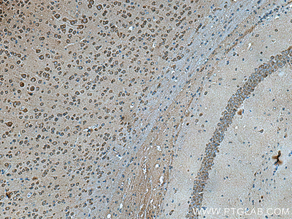 IHC staining of mouse brain using 67134-1-Ig (same clone as 67134-1-PBS)