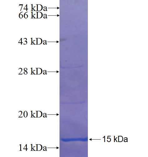 VSTM2A fusion protein Ag22378 SDS-PAGE