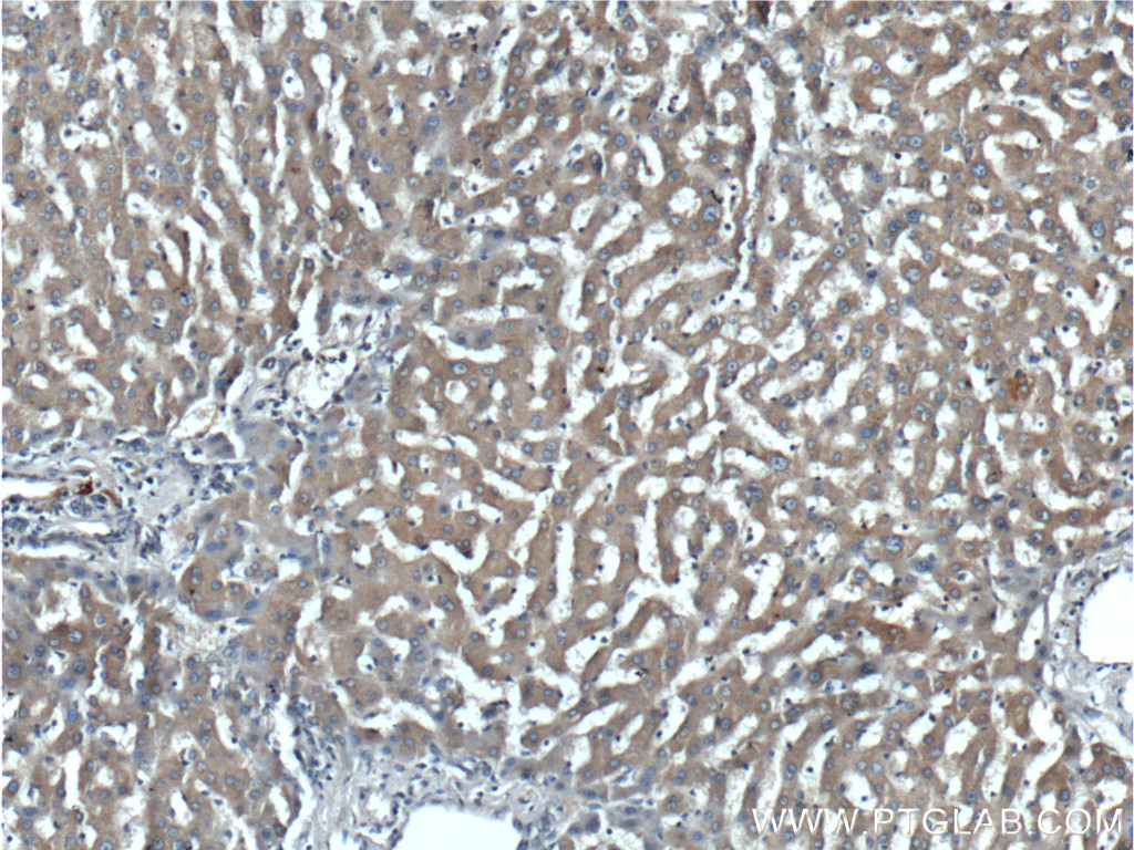 IHC staining of human liver using 25457-1-AP