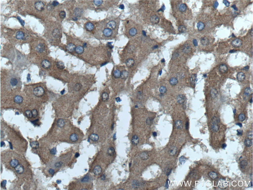 IHC staining of human liver using 25457-1-AP