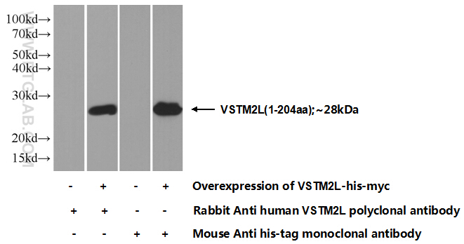 VSTM2L