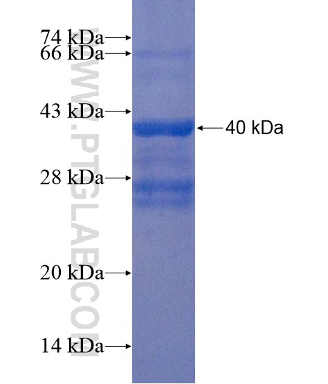 VSTM2L fusion protein Ag22292 SDS-PAGE