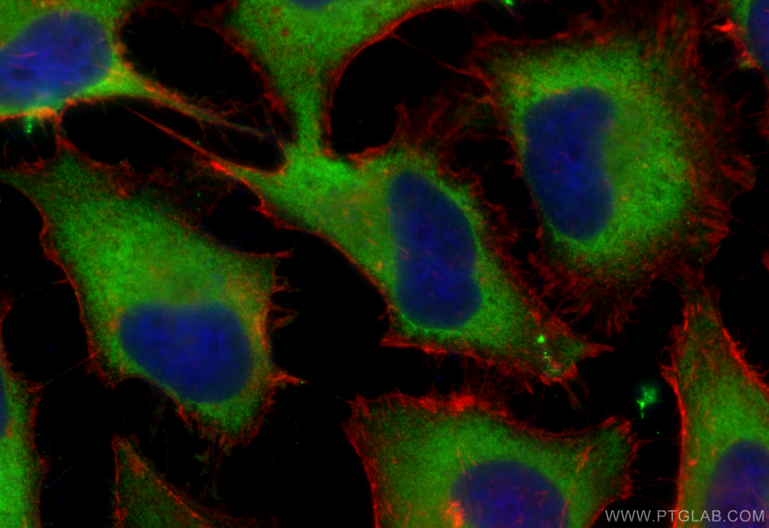 IF Staining of HeLa using 15786-1-AP