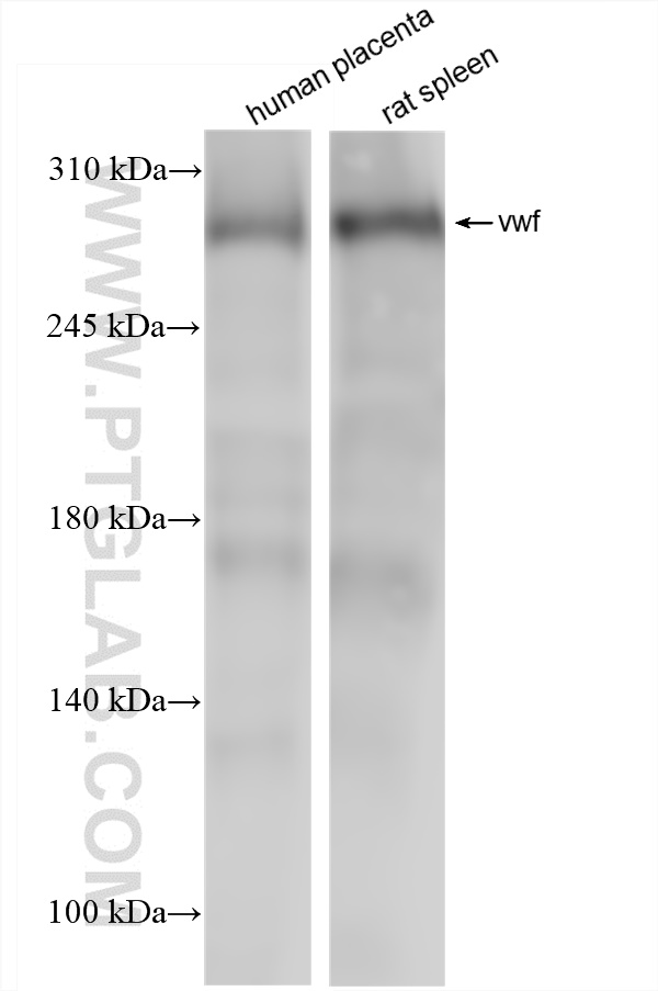 WB analysis using 83854-2-RR (same clone as 83854-2-PBS)