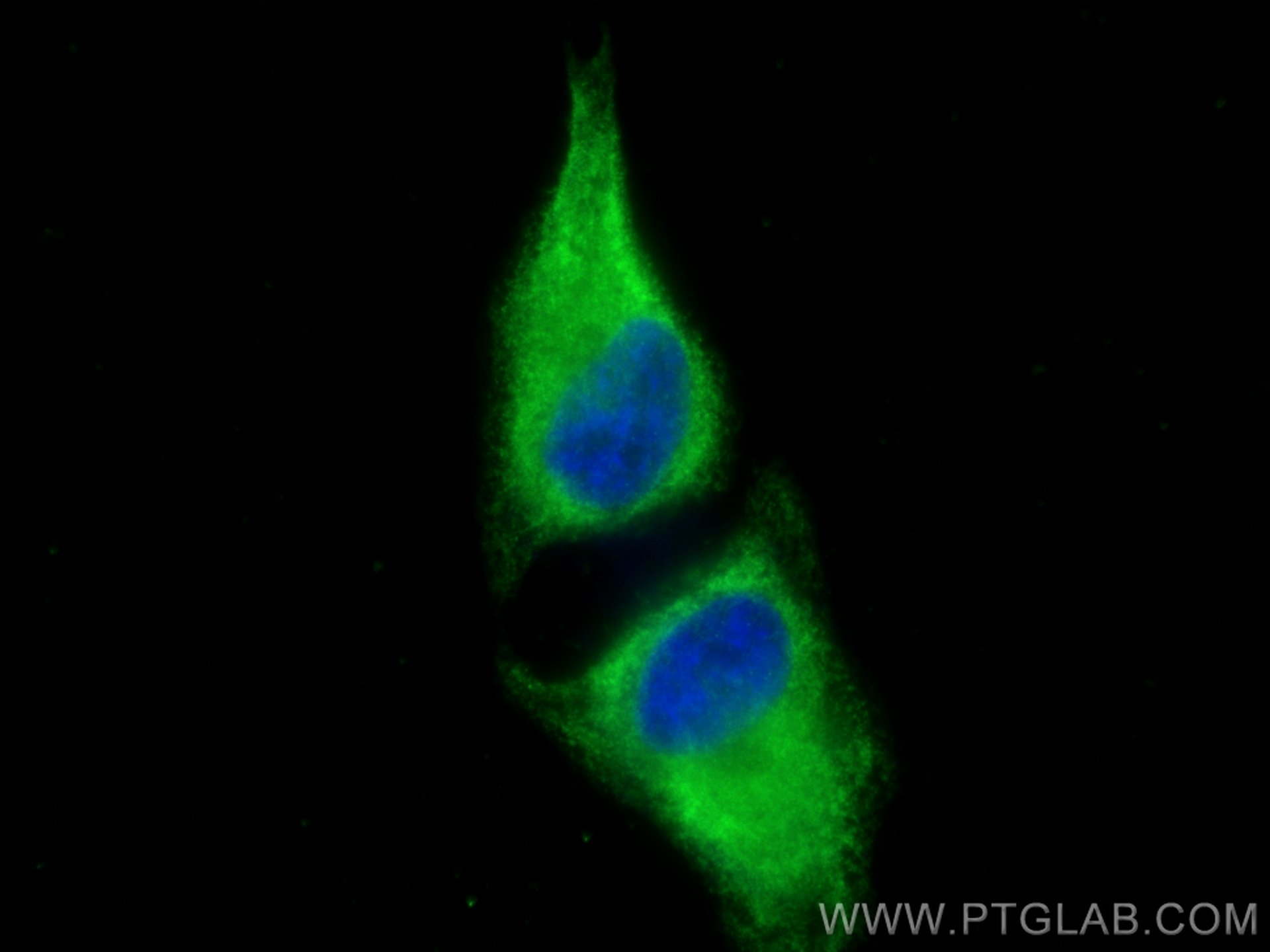 IF Staining of HeLa using 67935-1-Ig (same clone as 67935-1-PBS)