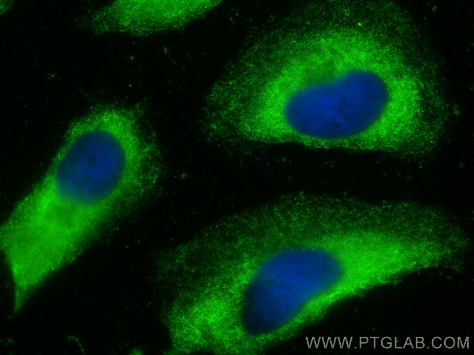 IF Staining of HeLa using 67573-1-Ig