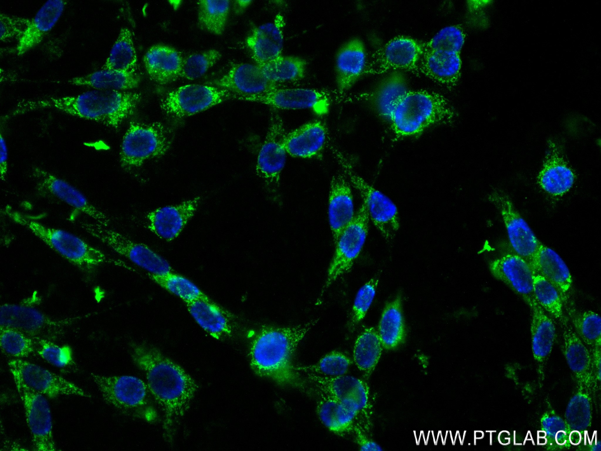 IF Staining of NIH/3T3 using 82864-9-RR