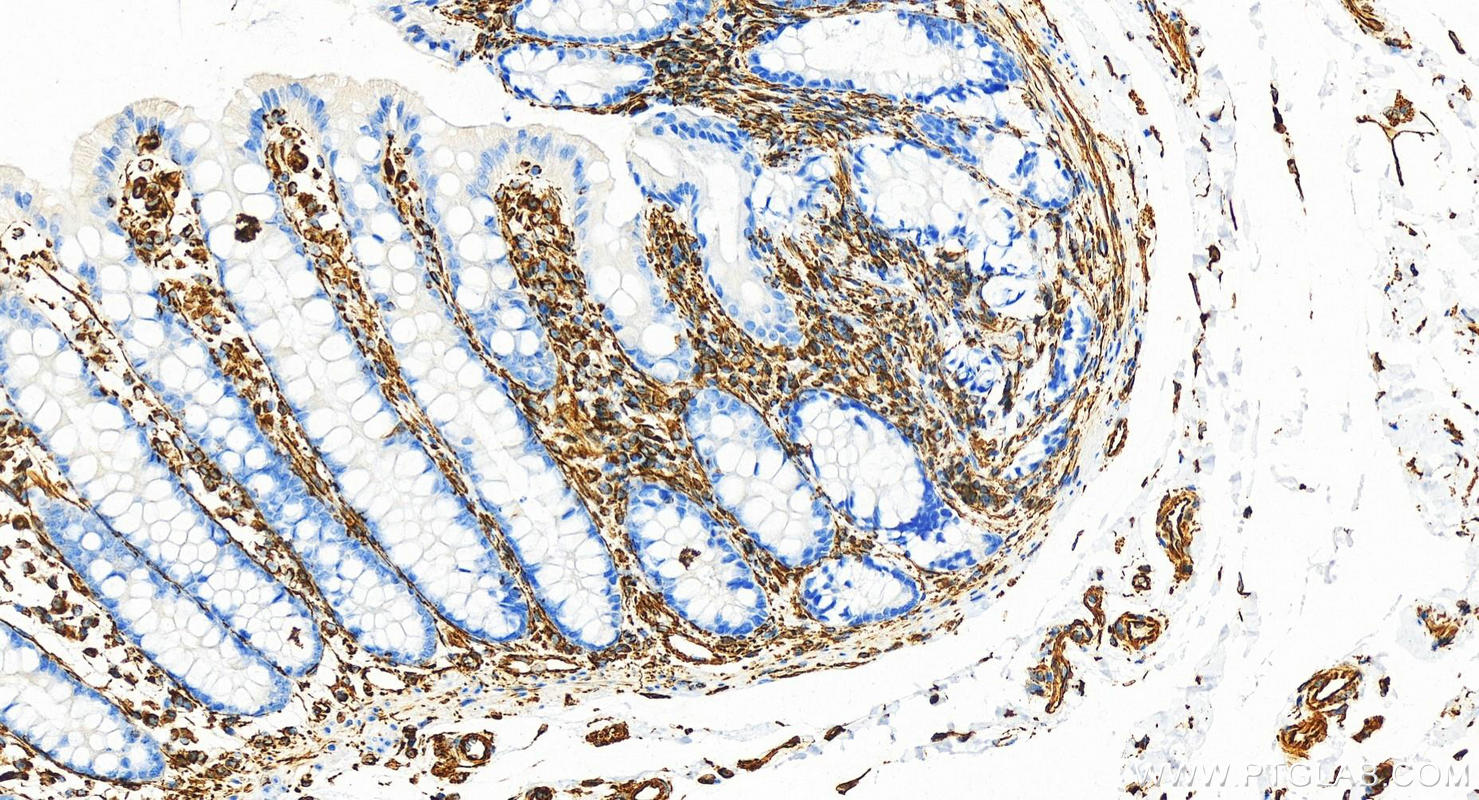 IHC staining of human colon using 80232-1-RR (same clone as 80232-1-PBS)