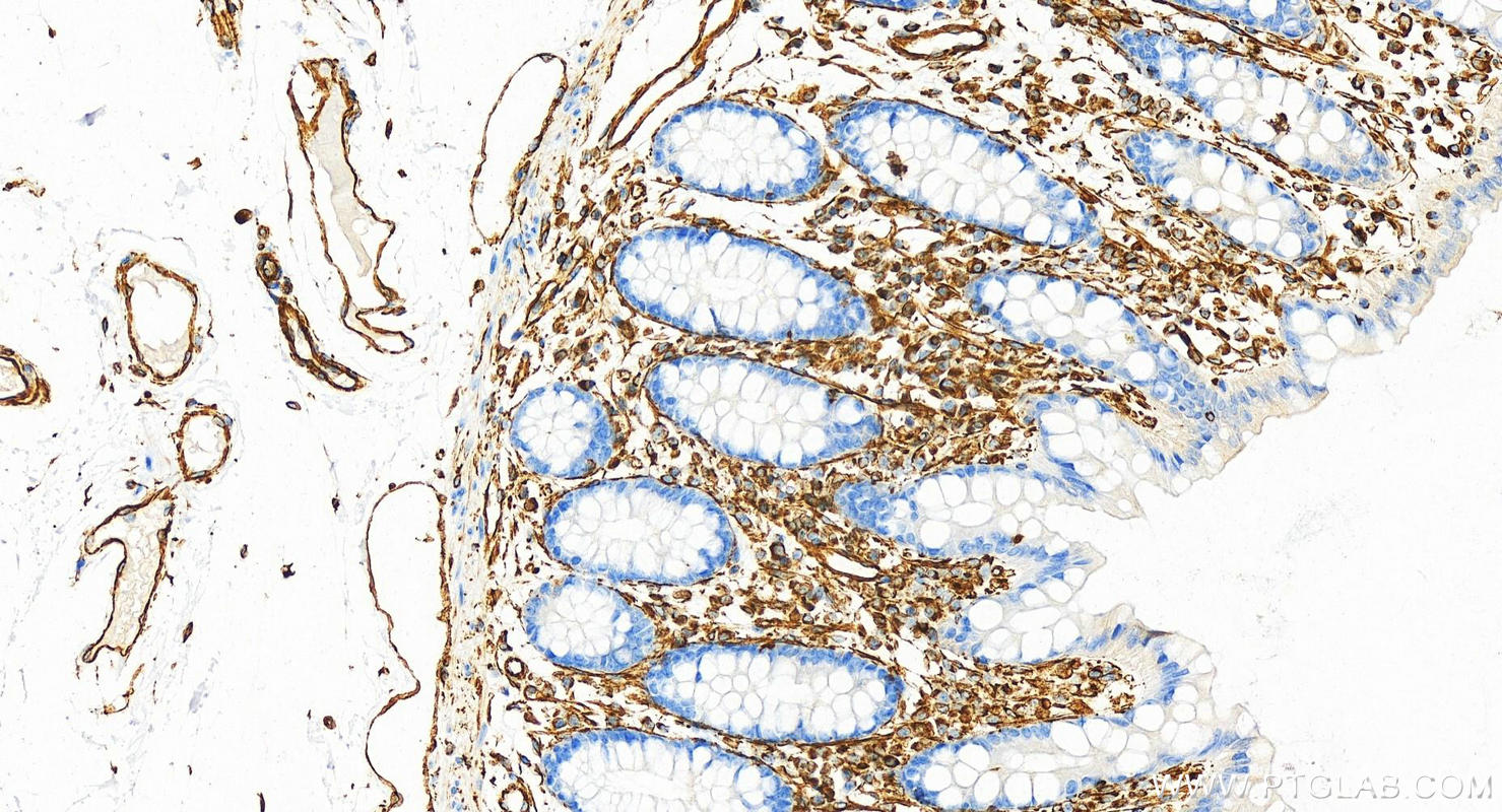 IHC staining of human colon using 80232-1-RR (same clone as 80232-1-PBS)