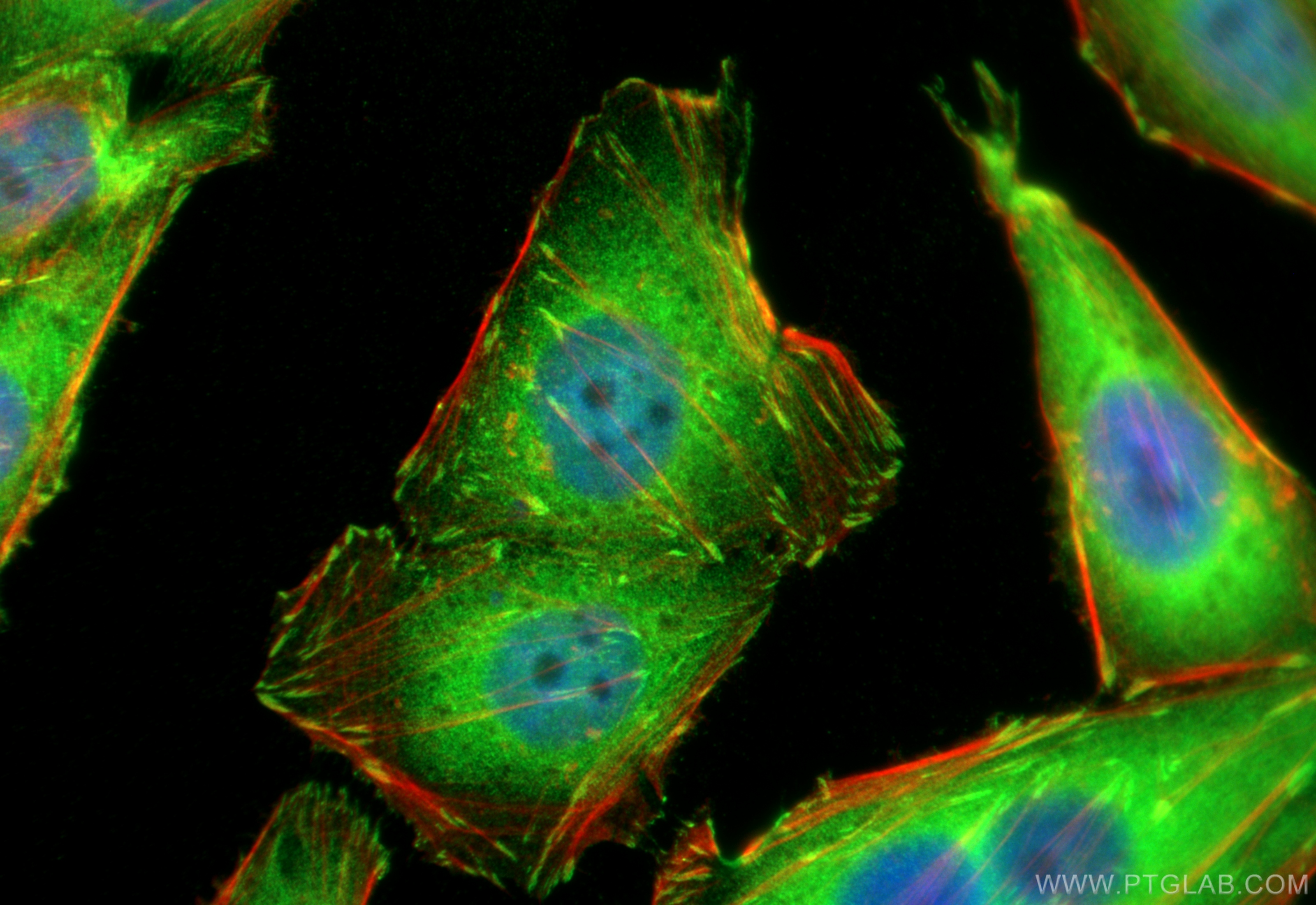 IF Staining of HepG2 using 26520-1-AP