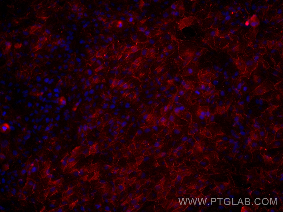 IF Staining of hTERT-RPE1 using 66305-2-Ig